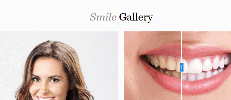 smile-gallery